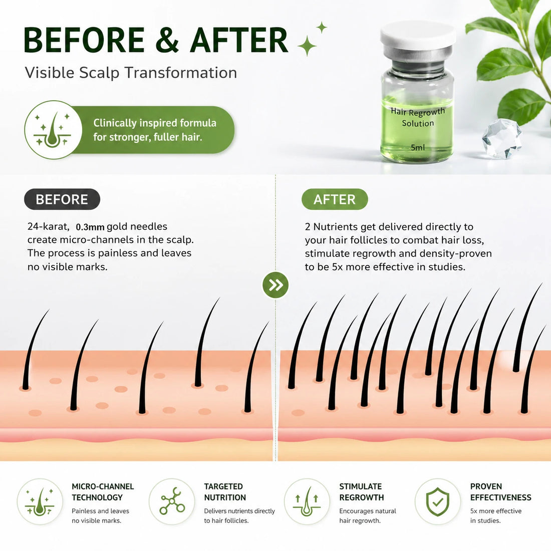 0.3mm Microneedle Hair Regrowth Kit, Scalp Nourishing Serum, Scalp Care Set for Hair Health Maintenance