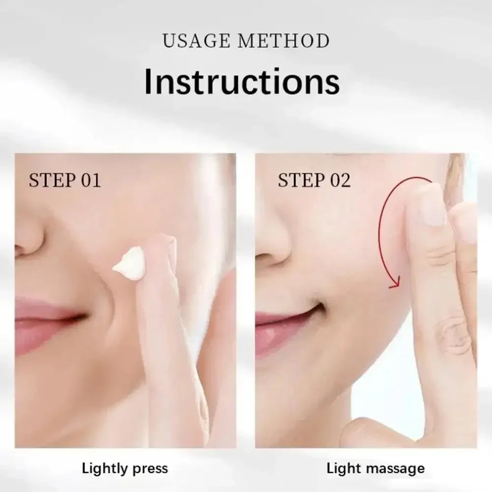 Whitening Freckles Face Cream Removal Melasma Dark Spots Corrector Lighten Melanin Pigmentation Brighten Anti-Aging Beauty Care Halalzen