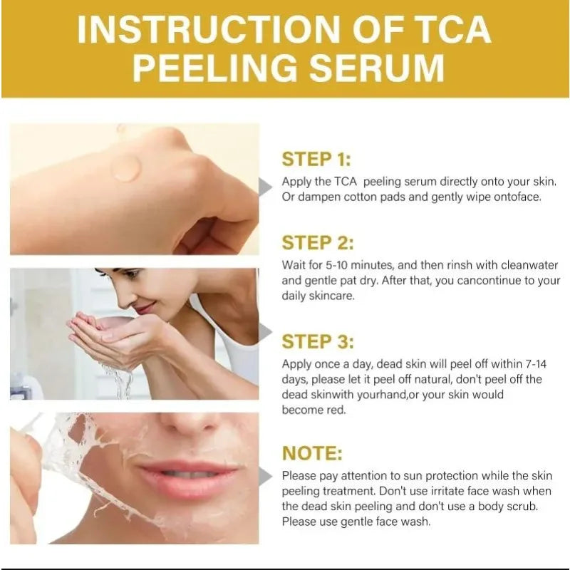 Dilute melanin, acne, 50% TCA, high-quality chemical exfoliation, acidic skin beauty care