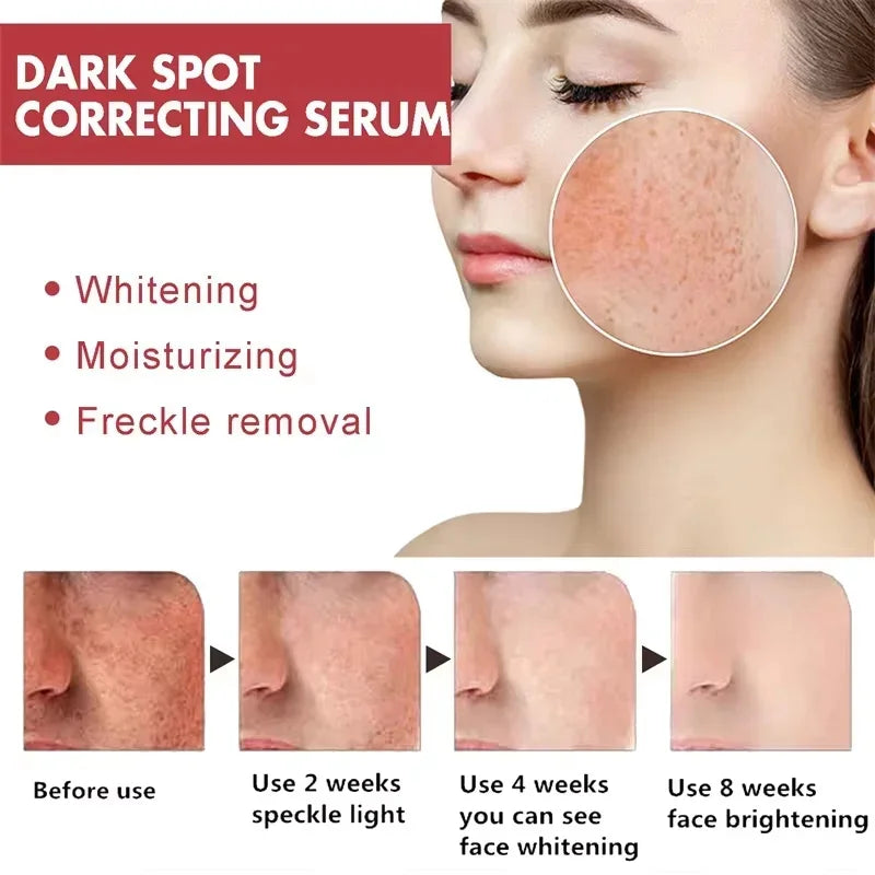 Powerful Dark Spots Remover Whitening Serum Face Freckle Melanin Correcting Anti Pigmentation Brighten Skin Beauty Care Essence