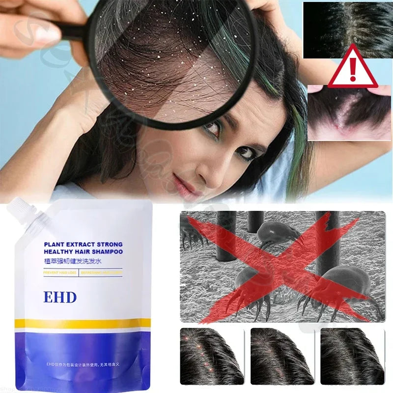 EHD natural organic hair shampoo nourishes, smoothes, fluffs, relieves itching, repairs hair roots and soothes hair follicles Halalzen
