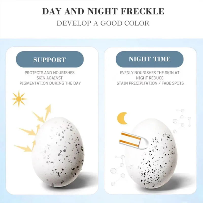 Melasma Brightening Face Cream Niacinamide Serum Brighten Cream Fade Fine Lines Lighten Dark Dot Reduce Melanin Face Skincare