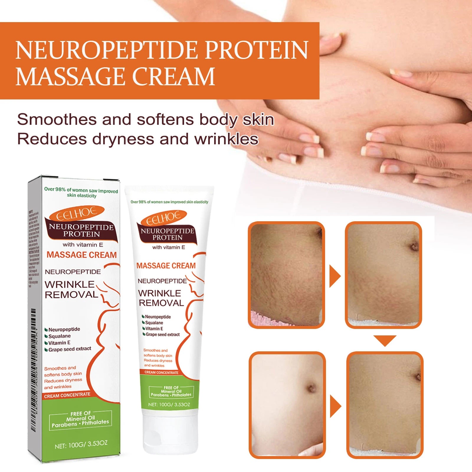 100g Stretch Marks Redece Cream Maternity Pregnant Women Pregnancy Faded Winkle Smooth Repair Firming Skin Body Care Product