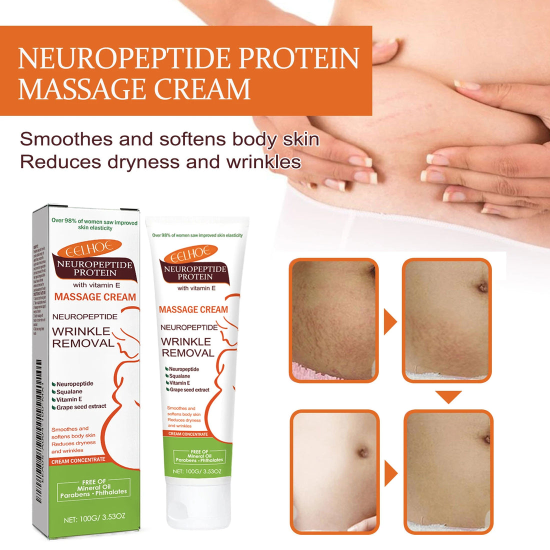 100g Stretch Marks Redece Cream Maternity Pregnant Women Pregnancy Faded Winkle Smooth Repair Firming Skin Body Care Product