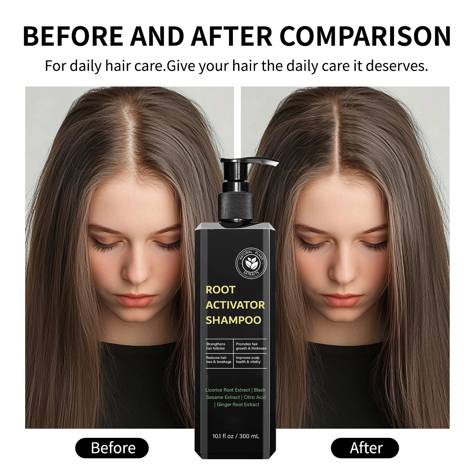 Root Activator Shampoo 300ml Hair Growth Treatment Anti-Hair Loss Strengthens Follicles Improves Scalp Health For Thinning Hair Halalzen