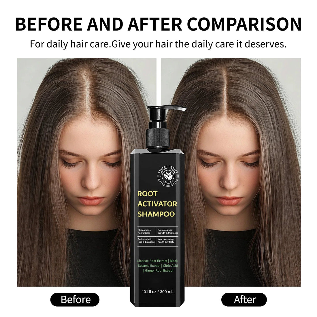 Root Activator Shampoo 300ml Hair Growth Treatment Anti-Hair Loss Strengthens Follicles Improves Scalp Health For Thinning Hair Halalzen