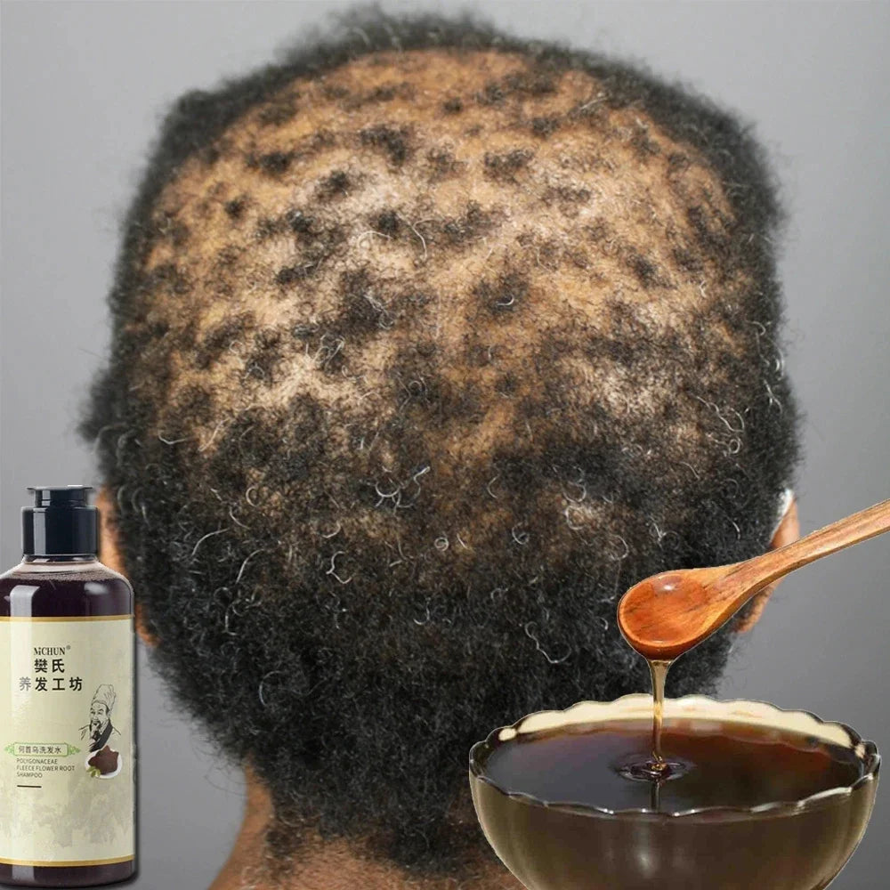 300ml Africa Women Traction Alopecia Treatment Hair Growth Product for Men Shampoo Hair Loss Treatment Get Rid of Wigs