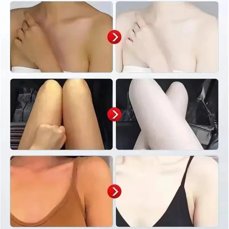 Remove Melanin Nicotinamide Brightening Cream For Dark Skin Effective Lighten Thigh Inner Bleach Private Parts Brighten 80g