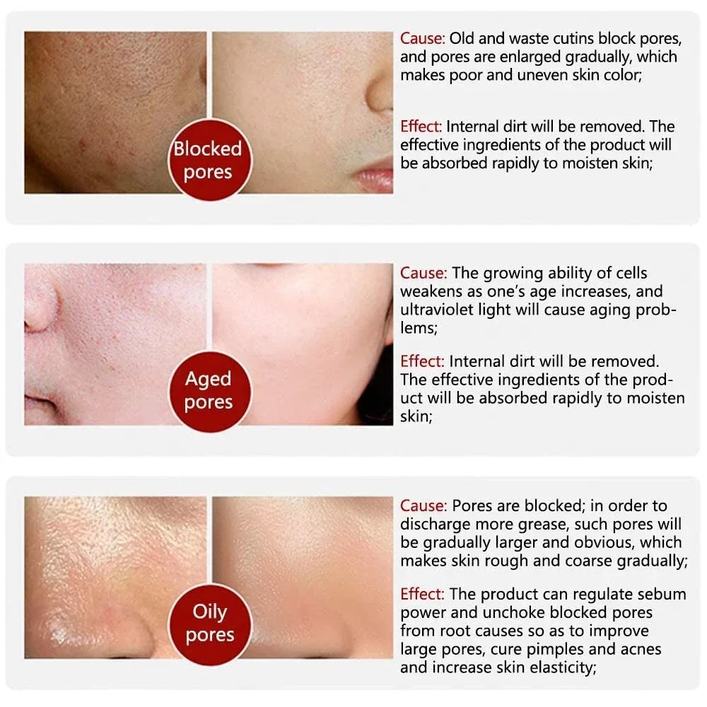 Skin Texture | Pore Refining Resurfacing, Brightening Facial Serum with Retinol and Niacinamide Non-Comedogenic Halalzen