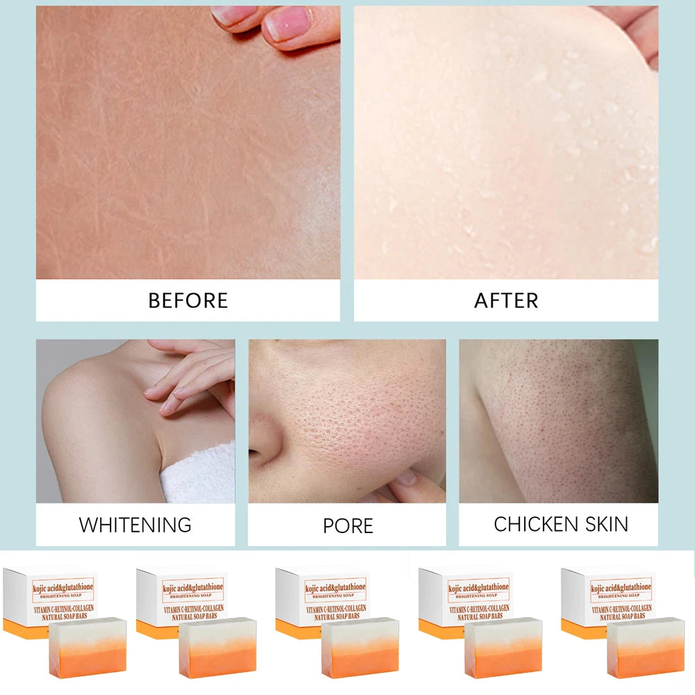 1/2/4/6Pcs 100gKojic Acid  Whitening Soap, Glutathione Skin Lightening, Anti-aging & Moisturizing Handmade Soap for Face & Body
