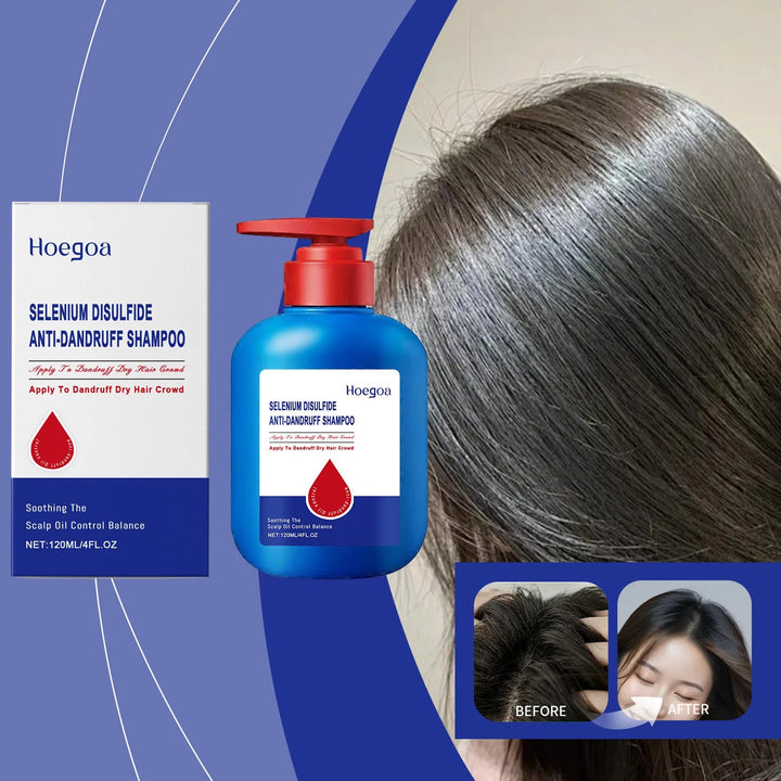 120ml Selenium Sulfide Shampoo Deep Cleansing Remove Dandruff Itchy Balance Oil Nourishing Restoration Hair Color Shampoo HALALZEN