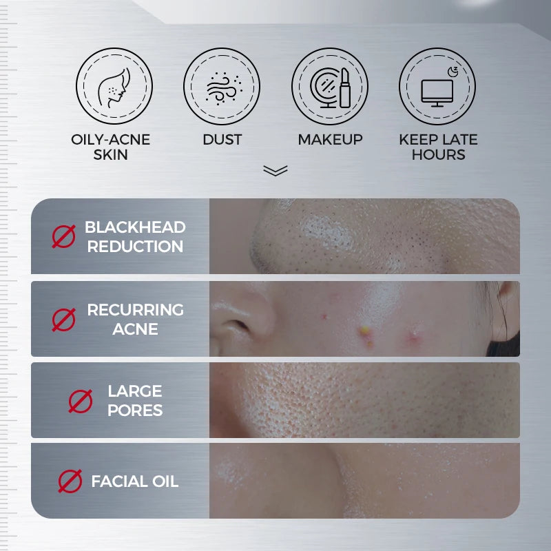 200ML Amino Acid Korean Facial Cleanser with Salicylic Acid Help with Pore Tighten, Acne & Blackheads Halalzen
