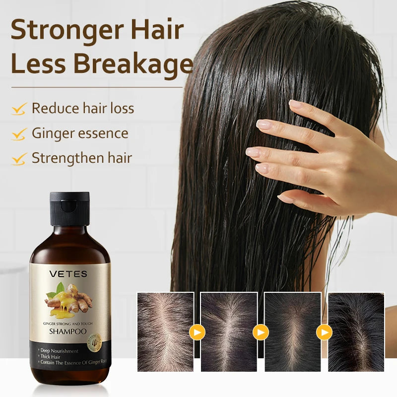 Vetes Shampoo and Shower Gel 260ml Oil-Control Whole body cleaning deep Nourish and Relieve Itching Care Moisturizing and Repair Halalzen