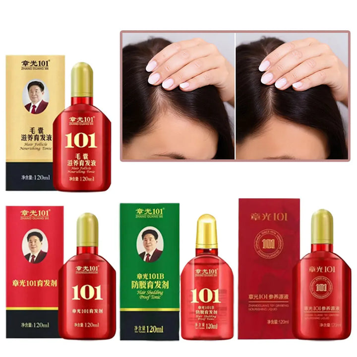 Hair Tonic Zhangguang 101B Powerful Chinese Medicine Therapy Anti Hair Loss Strengthen Hair Roots Treatment Essence