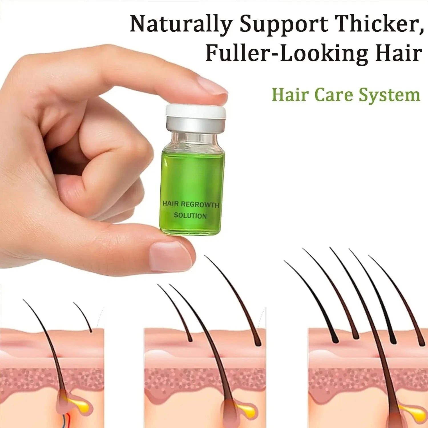 0.25mm Scalp Micro‑Needle Roller Set with 8×5ml Ampoules Nourish Follicles Reduce Loss & Breakage Boost Scalp Density