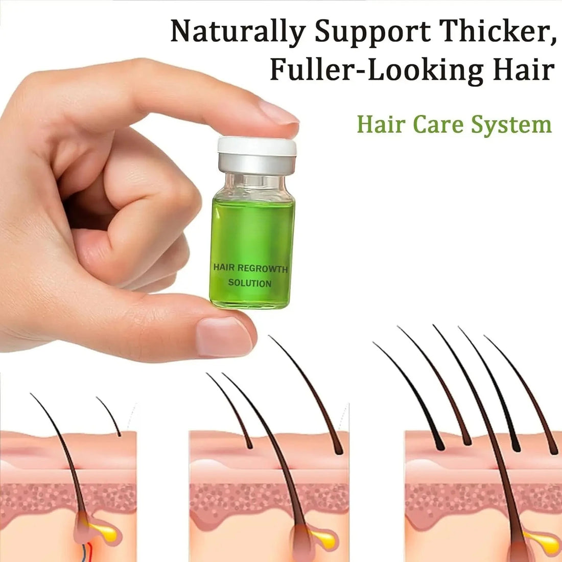 0.25mm Scalp Micro‑Needle Roller Set with 8×5ml Ampoules Nourish Follicles Reduce Loss & Breakage Boost Scalp Density