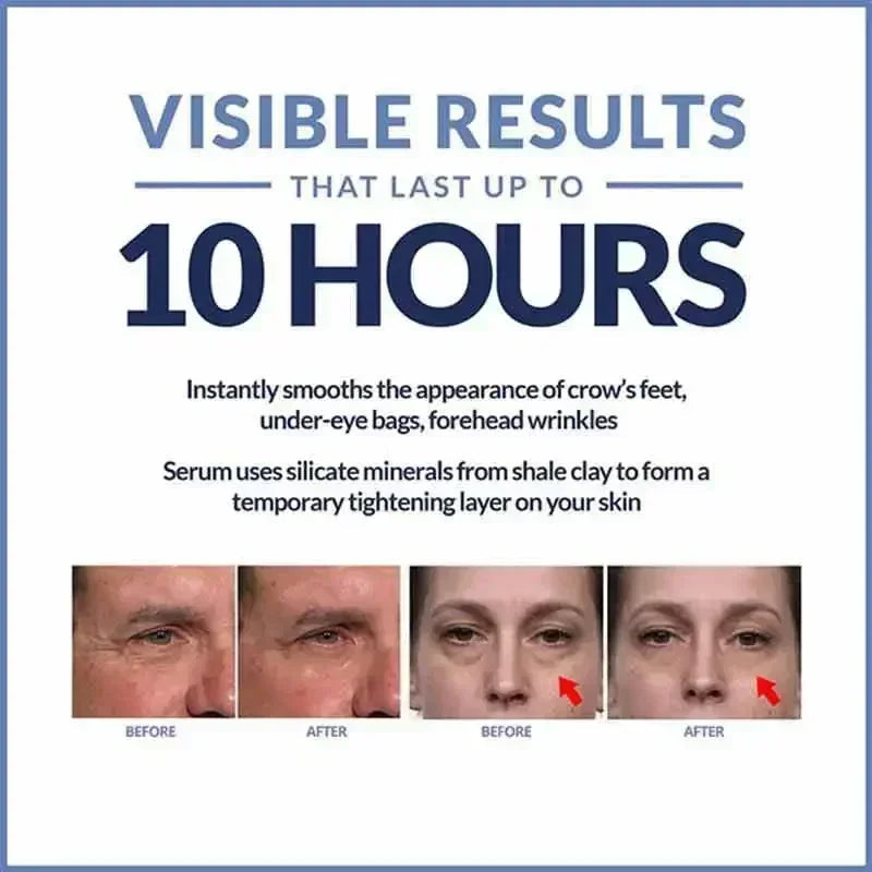 Instant Eye Cream For Anti Aging Dark Circles Bags Puffiness Great Under Eye Skin Face Tightening Eye Lift Treatment Care Halalzen