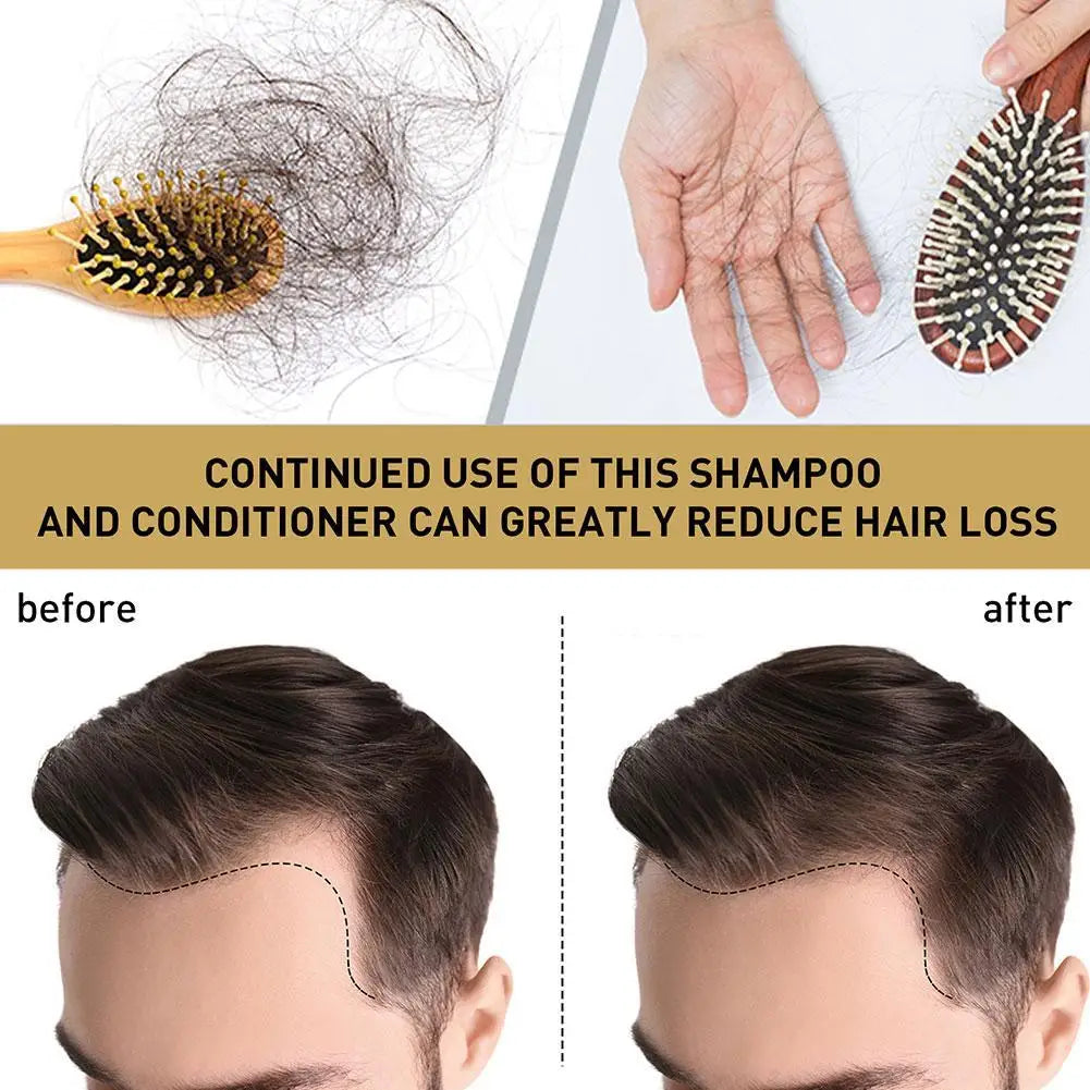 Ginger Regrowth Shampoo Anti Hair Loss Oil Control Dandruff Removal Moisturiz Nourish Scalp Repair Damaged Hair Growth Shampoo