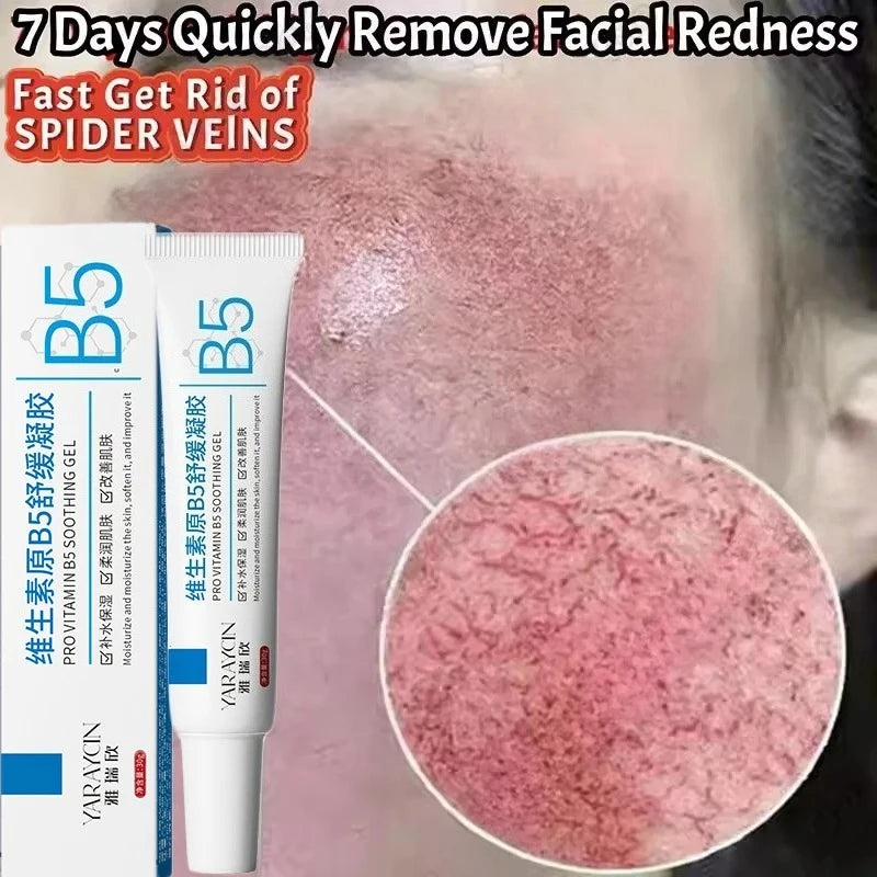 Facial Redness Repair Cream Improve Sensitive Skin Dryness Moisturizer Hydrating Sooth Lotion Removal Rosacea Korean Cosmetics Halalzen