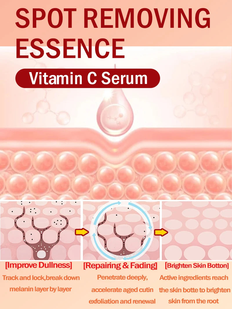 Lighten Freckles Melasma, Facial Dark Spots