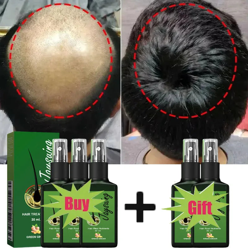 Fast Hair Growth Serum Spray Anti Hair Loss Prevent Baldness Scalp Treatment Repair Roots Beauty Health Hair Care For Men Women HALALZEN