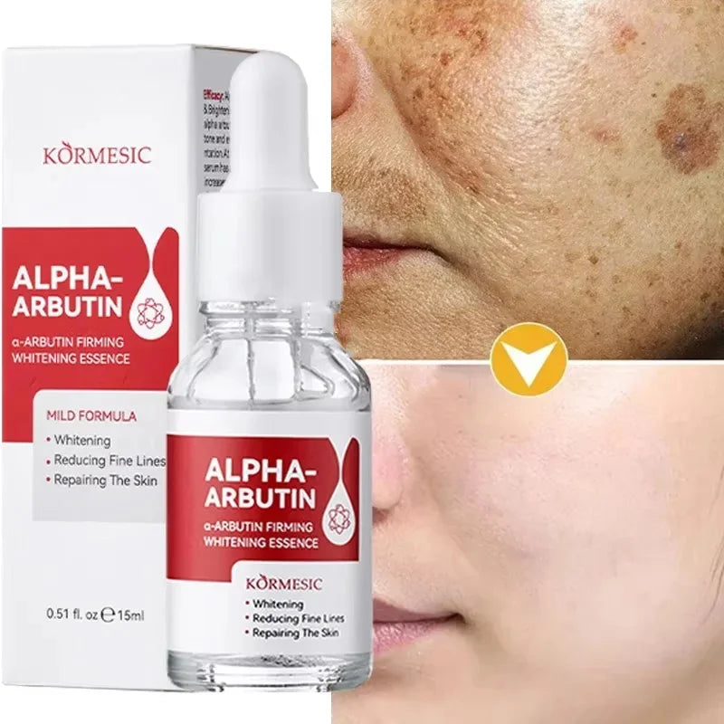 Powerful Dark Spots Remover Whitening Serum Face Freckle Melanin Correcting Anti Pigmentation Brighten Skin Beauty Care Essence