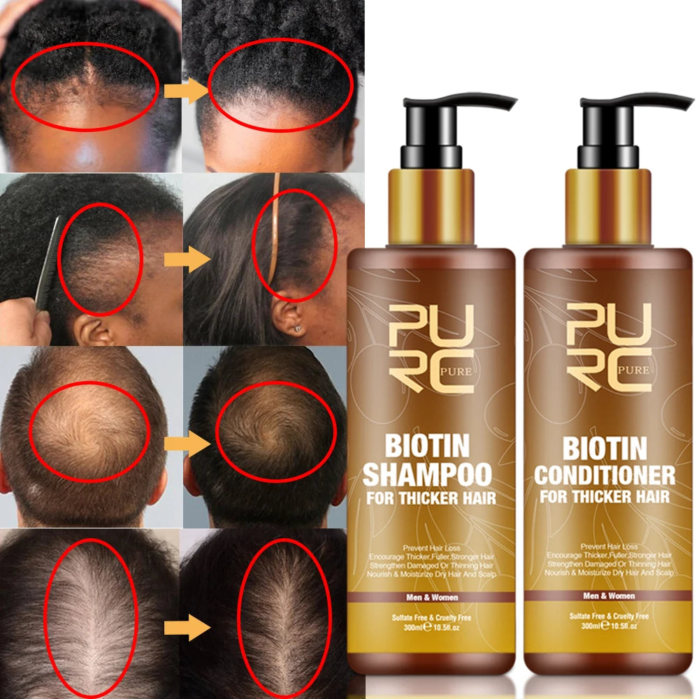 PURC Smoothing Hair Scalp Treatment Hair Shampoo Biotin Hair Oil and Conditioner Set for Men Women Hair Care Halalzen