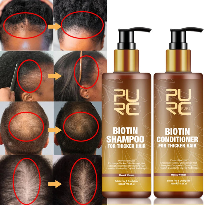 PURC Smoothing Hair Scalp Treatment Hair Shampoo Biotin Hair Oil and Conditioner Set for Men Women Hair Care Halalzen