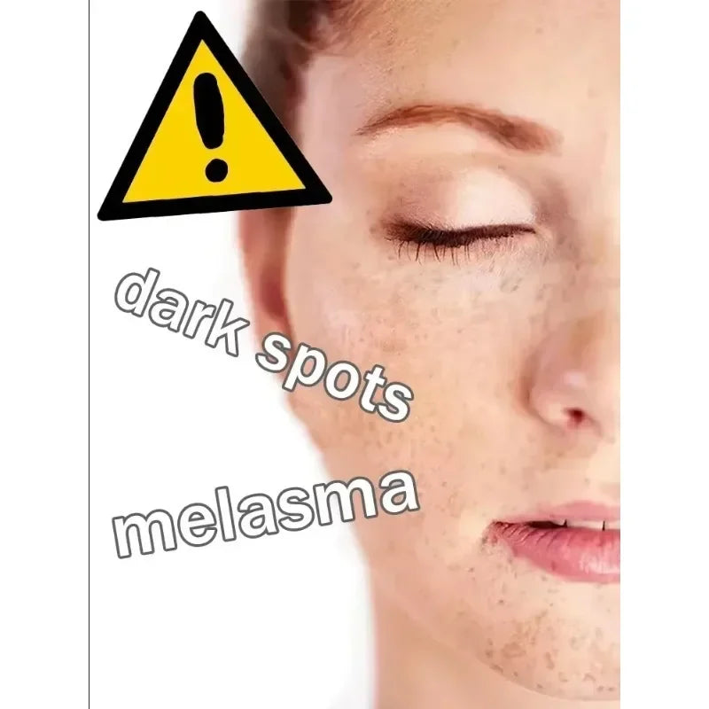 Dark Spot Remover for Face Removing Freckle target hyperpigmentation  age spots sun spot Whitening MOISTURIZING skin beauty care