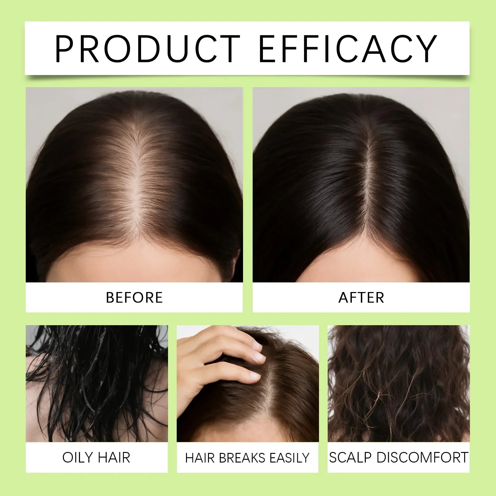 0.2MM Microneedle Hair Growth Treatment Kit, Scalp Nourishing Serum, Household Scalp Care Set for Thicker Healthier Hair