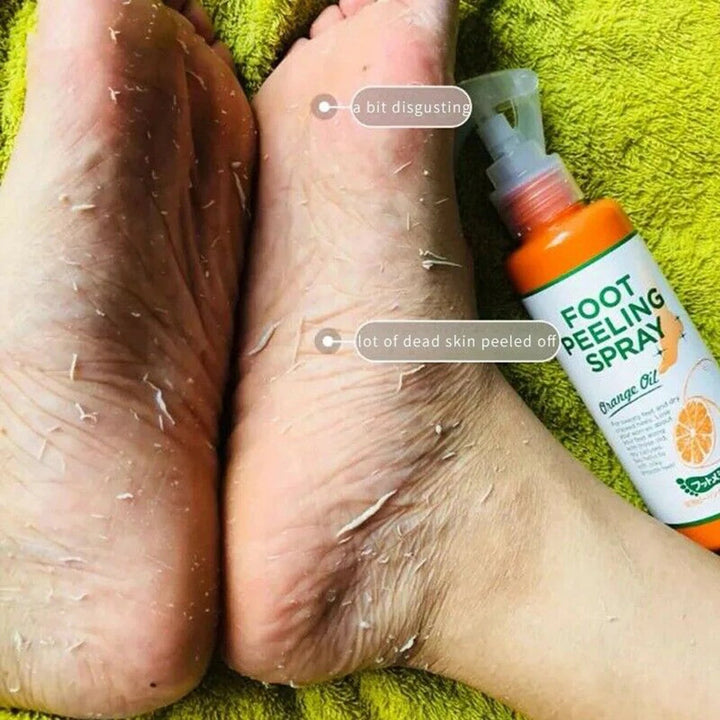110ML Foot Cuticle Remove Dead Foot Exfoliator Softener Remove Dead Skin and Calluses Foot Mask Pedicure Nail Enhancer Halalzen