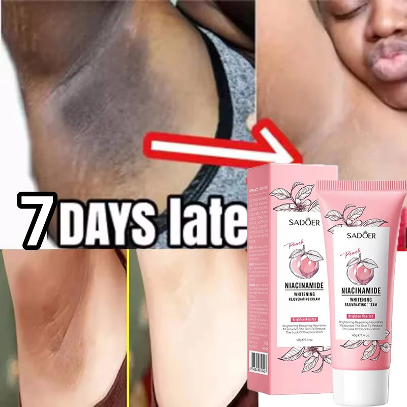 Remove Melanin Nicotinamide Brightening Cream For Dark Skin Effective Lighten Thigh Inner Bleach Private Parts Brighten Cream