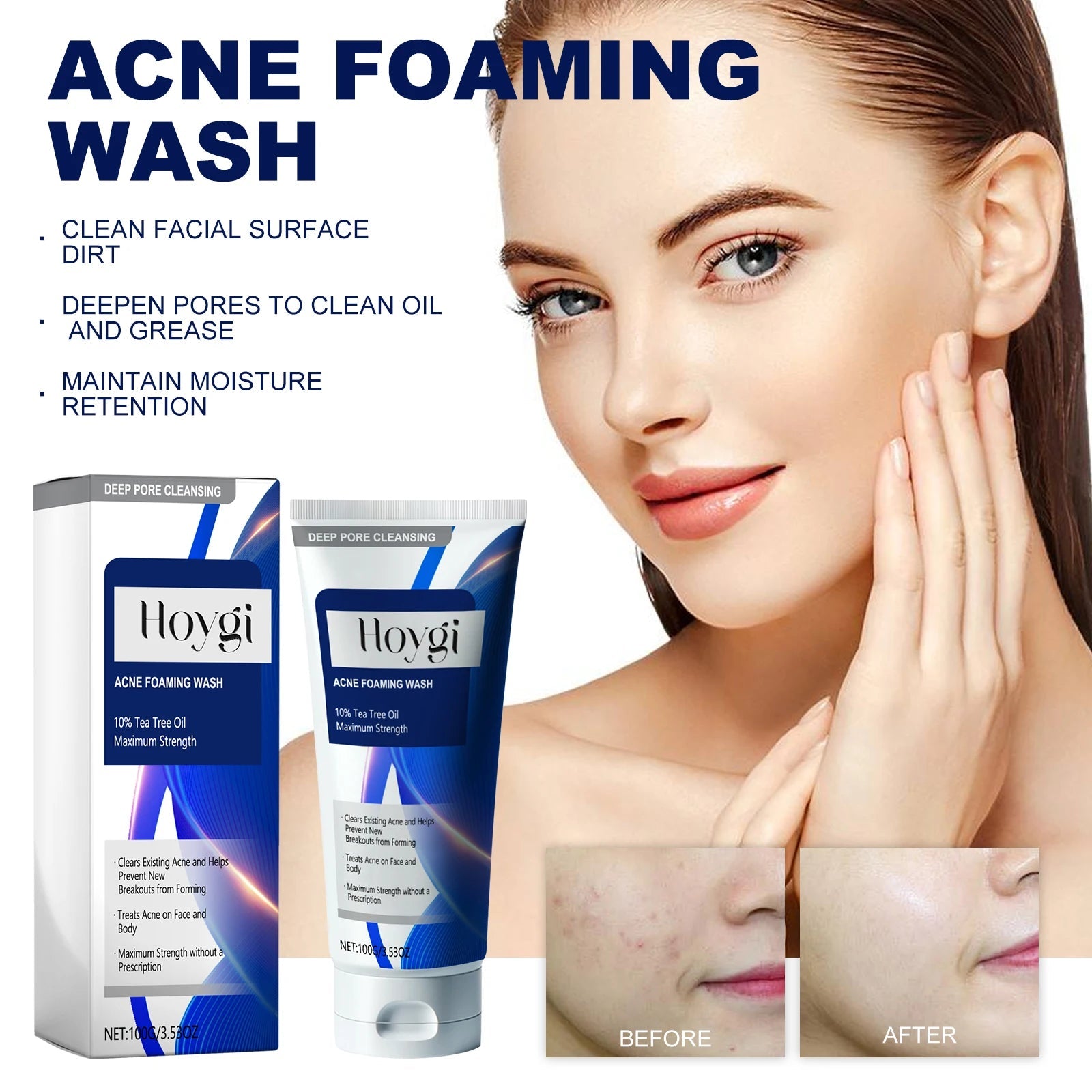 Facial Cleanser Anti Acne Oil Control Blackhead Remover Shrink Pores Deep Cleansing Acne Treatment Moisturizing Face Wash 100g Halalzen