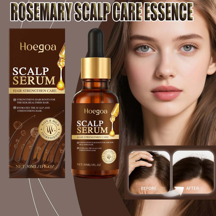 Scalp Care Essence Rosemary Castor Oil Nourishing Hair Growth Strengthening Dry Scalp Thinning Hair Moisturizing Healthy Hair HALALZEN
