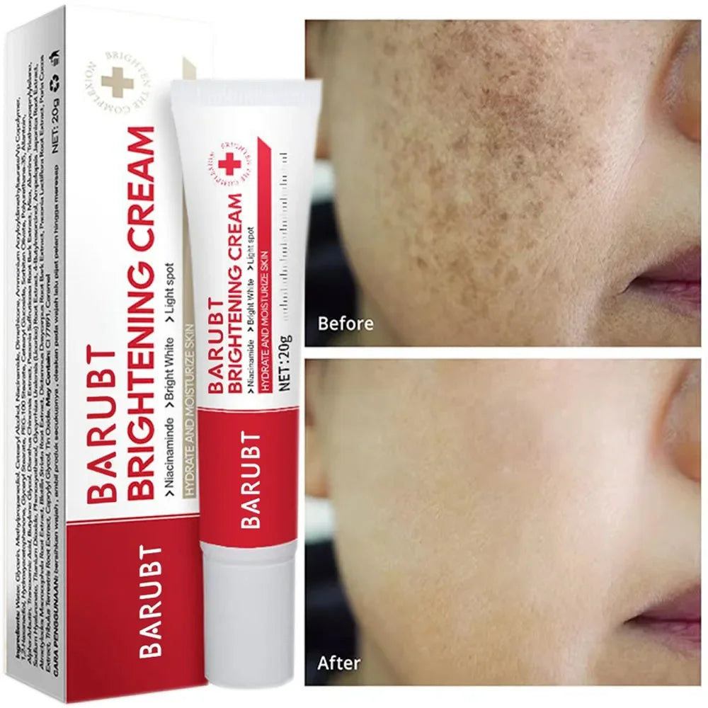 Whitening Freckles Face Cream Removal Melasma Dark Spots Corrector Lighten Melanin Pigmentation Brighten Anti-Aging Beauty Care Halalzen