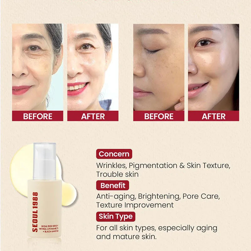 1/2PCS Korean SEOUL 1988 Retinol Face Serum Fade Fine Wrinkle Moisturizing Whitening Remove Spots Shrink Pores Beauty Skin Care Halalzen