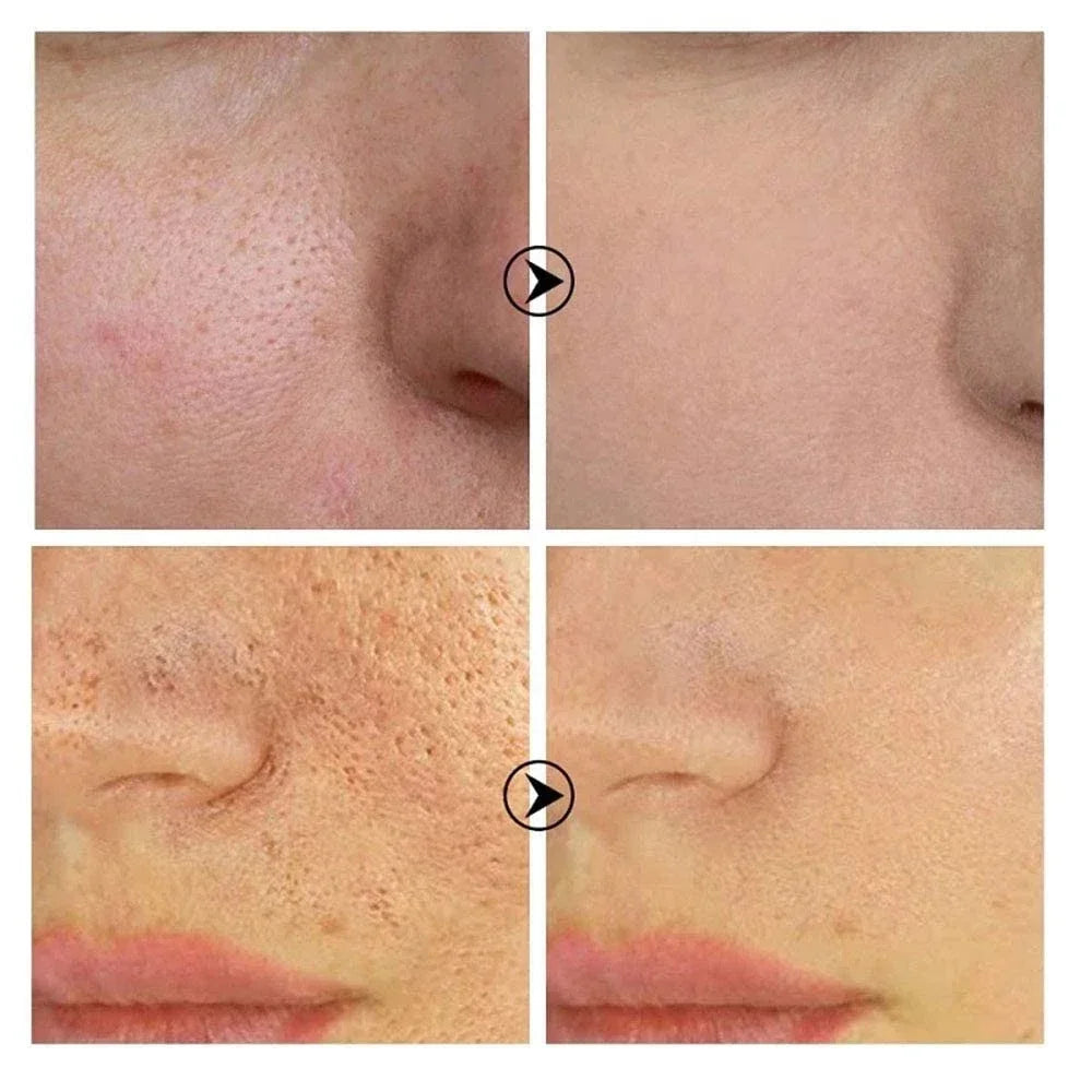 Skin Texture | Pore Refining Resurfacing, Brightening Facial Serum with Retinol and Niacinamide Non-Comedogenic Halalzen