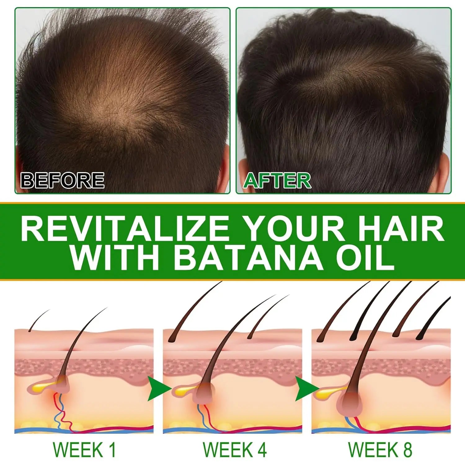 Amococo Batana Oil with Rosemary Hair Scalp Nourishing Oil Natural Hair Strengthening Serum for Dry Ends Frizz Control 60ml X 2 + 30ml X 1