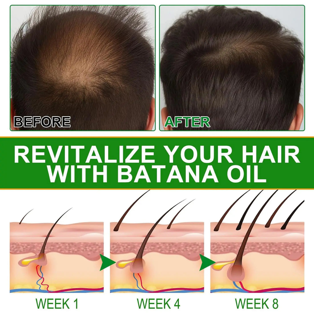Amococo Batana Oil with Rosemary Hair Scalp Nourishing Oil Natural Hair Strengthening Serum for Dry Ends Frizz Control 60ml X 2 + 30ml X 1