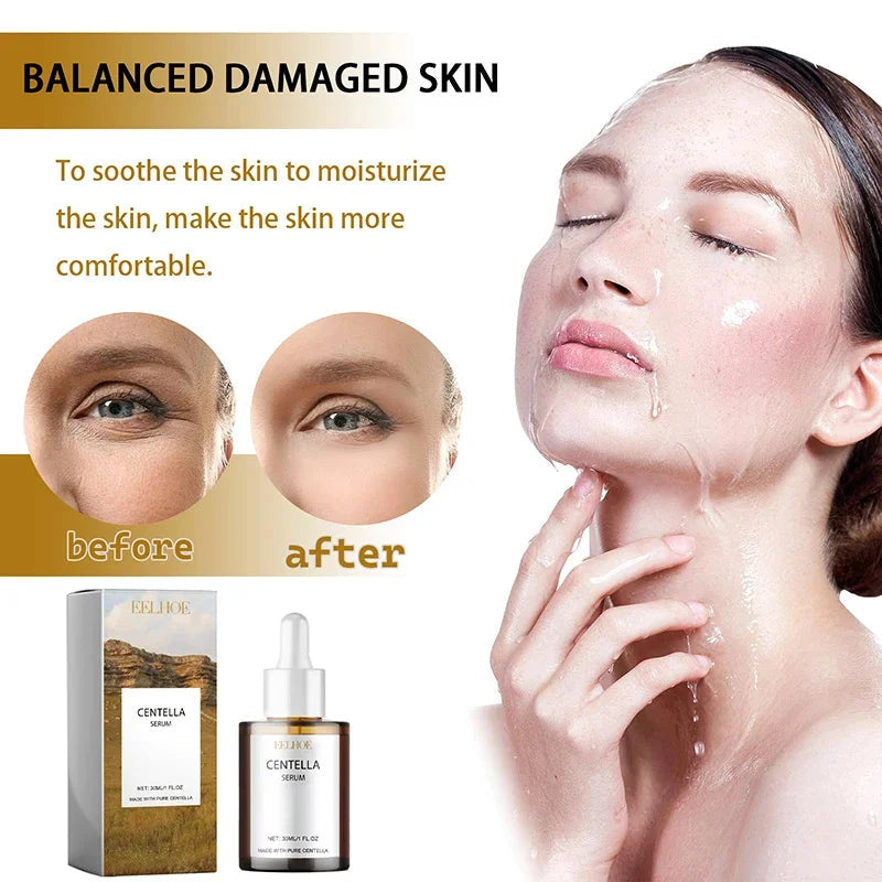 Centella Asiatica Face Serum Nourish Dry Skin Smoothing Rejuvenation Skin Brightening Whitening Cream Facial Moisturizer Korean Halalzen
