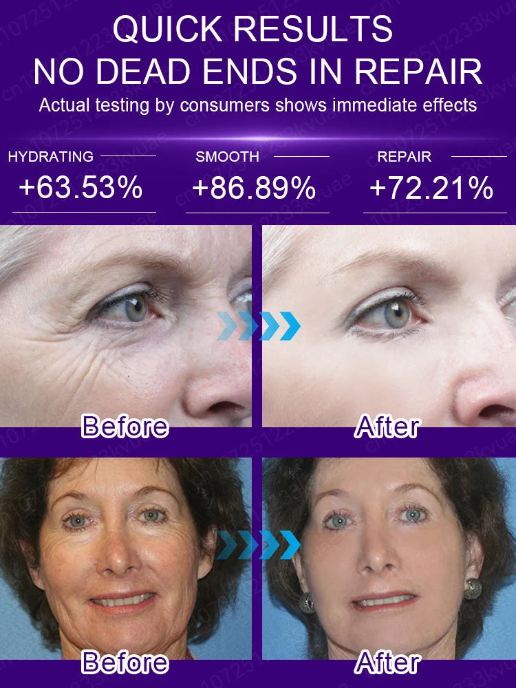 No wrinkles, 20 years younger