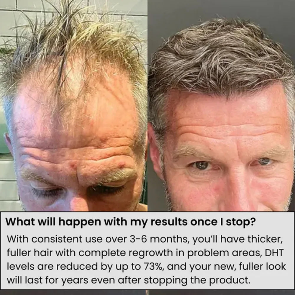 Hair Roller Serum Gentle nourishes the scalp and cares for the softening hair care Daily Care Scalp Serum HALALZEN