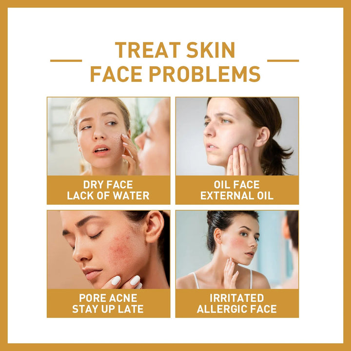 Wrinkle Removal White Rice Serum Anti Aging Puffiness Reduce Fine Lines Shrink Pores Nourishing Dry Skin Ac-ne Treatment Essence Halalzen