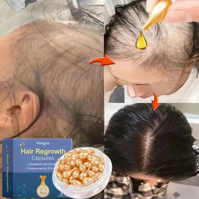 Hair Growth Serum 7 Day Fast Regrowth Essential Capsule Anti Hair loss Baldness Repair Damaged Scalp Treatment For Women Men New
