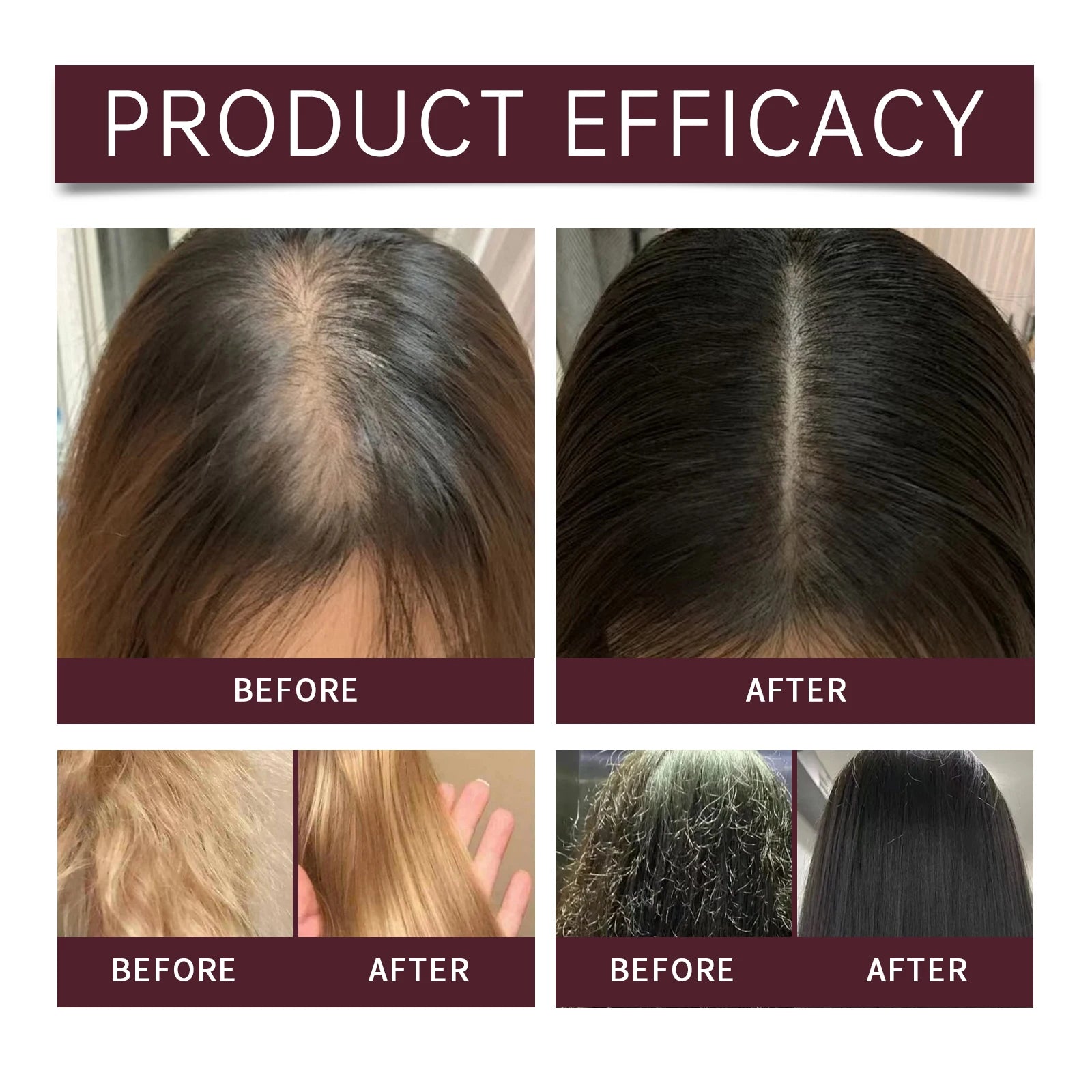Organic Batana Hair Shampoo Gentle Nourishing Scalp Refreshing Oil Control Dandruff Removal Hair Care Scalp Cleansing Shampoo