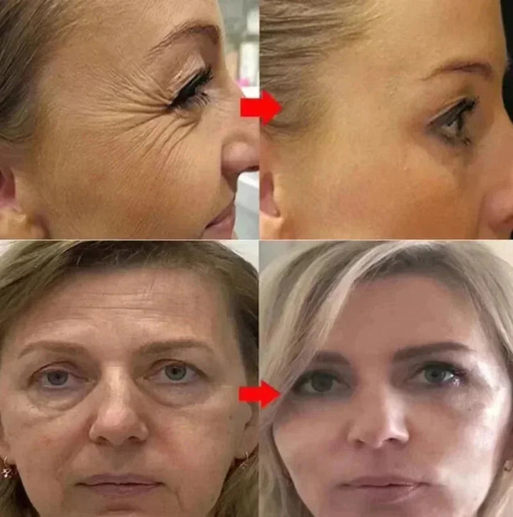 Facial Retinol Serum Whitening Moisturising Fade Fine Lines Anti Wrinkle Anti Ageing Rejuvenate Your Face Korean Cosmetics 30ml Halalzen