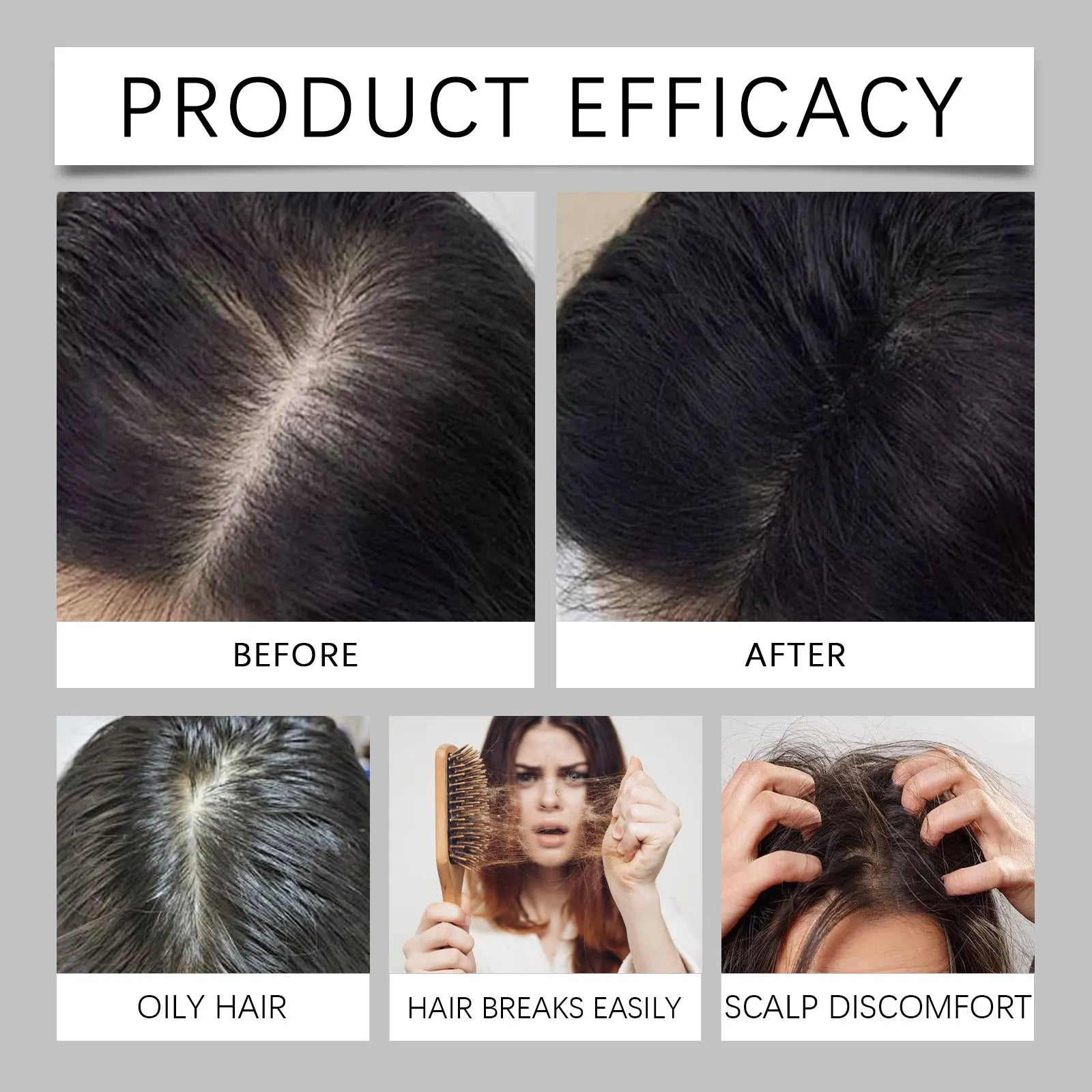 Polygonum Multiflorum Hair Care Spray Biotin Nourishes Scalp Strengthens Hair Roots Smoothing Hair Care Essence Conditioner