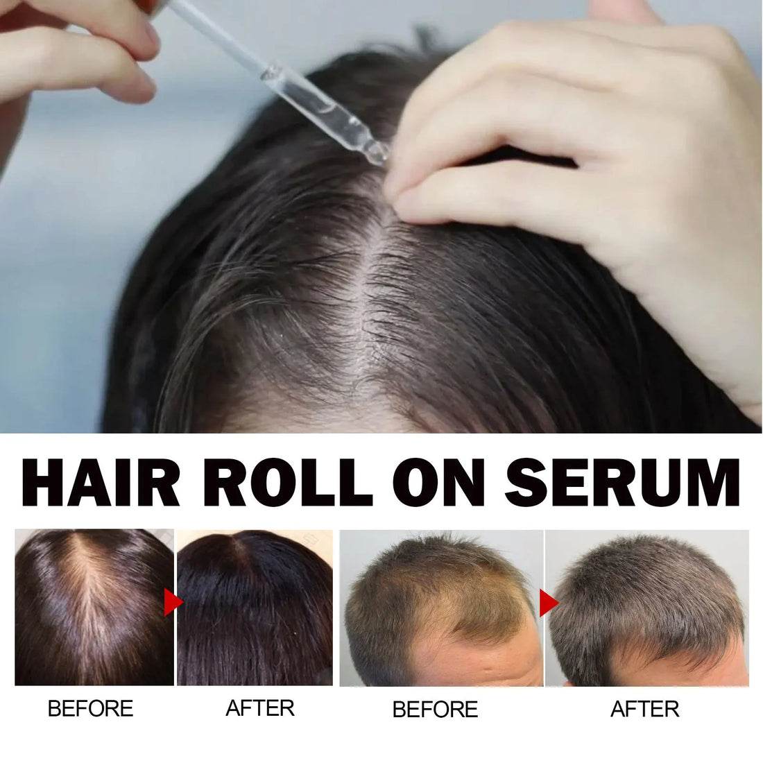 Eelhoe Jojoba Oil Hair Growth Serum Reduce Loss Scalp Treatment More Thicker Keep Regrowth Oil Control Hair Nourish Essencial Oi