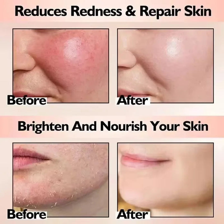 Facial Redness Repair Cream Improve Sensitive Skin Dryness Moisturizer Hydrating Sooth Lotion Removal Rosacea Korean Cosmetics Halalzen