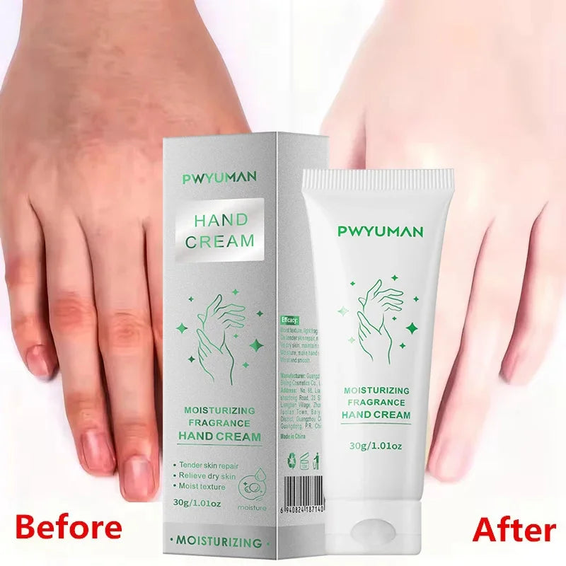 Remove Melanin Nicotinamide Brightening Cream For Dark Skin Effective Lighten Thigh Inner Bleach Private Parts Brighten 80g